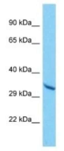 OR10A6 Rabbit anti-Human, Polyclonal, Novus Biologicals:Antibodies:Primary